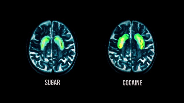 Sugar and cocaine have a similar effect on brain activity, but only one is legal.